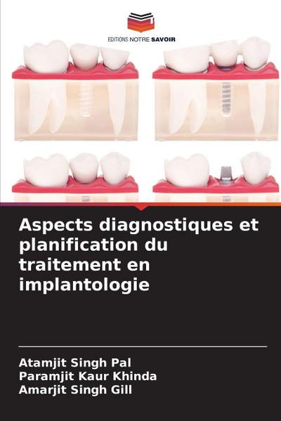 Aspects diagnostiques et planification du traitement en implantologie