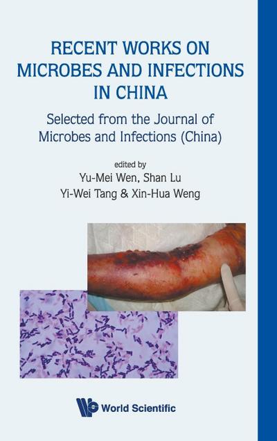 Recent Works on Microbes and Infections in China