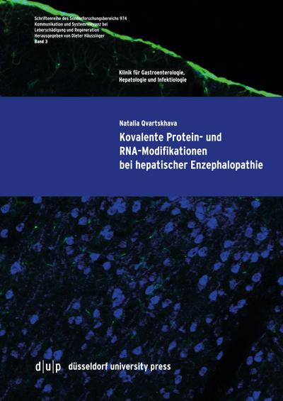 Kovalente Protein- und RNA-Modifikationen bei hepatischer Enzephalopathie