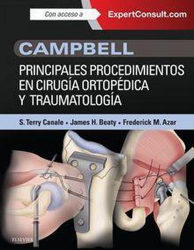 Campbell : principales procedimientos en cirugía ortopédica y traumatología ; Expertconsult