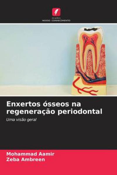 Enxertos ósseos na regeneração periodontal
