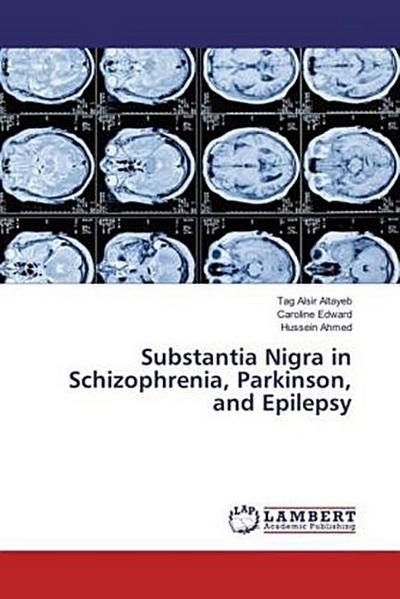Substantia Nigra in Schizophrenia, Parkinson, and Epilepsy