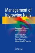 Management of Ingrowing Nails