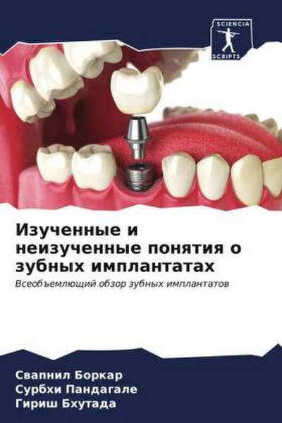 Izuchennye i neizuchennye ponqtiq o zubnyh implantatah