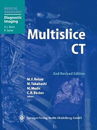 Multislice CT