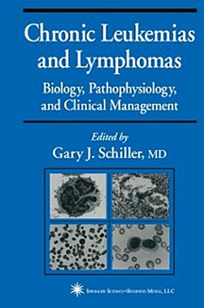 Chronic Leukemias and Lymphomas