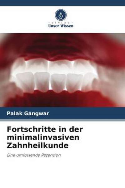 Fortschritte in der minimalinvasiven Zahnheilkunde