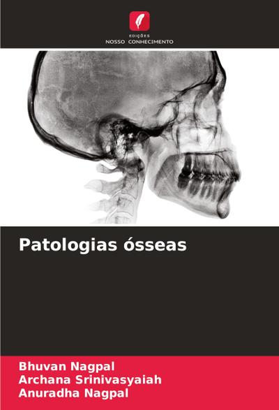 Patologias ósseas