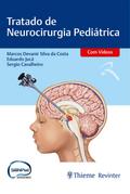 Tratado de Neurocirurgia Pediátrica