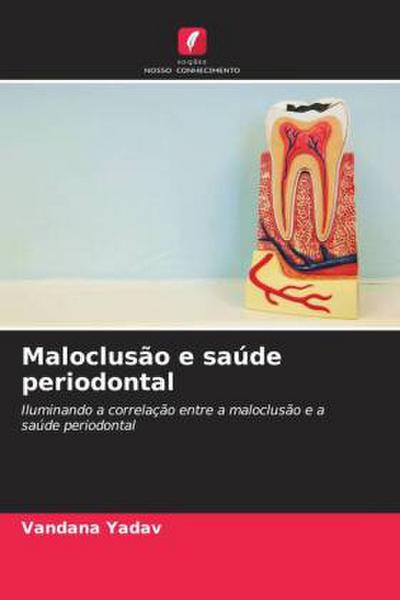 Maloclusão e saúde periodontal