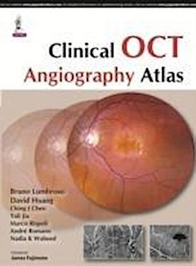 Clinical OCT Angiography Atlas