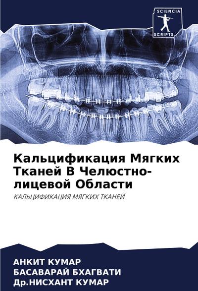 Kal’cifikaciq Mqgkih Tkanej V Chelüstno-licewoj Oblasti