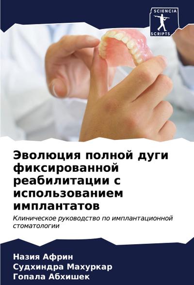 Jewolüciq polnoj dugi fixirowannoj reabilitacii s ispol’zowaniem implantatow