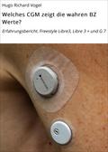 Welches CGM zeigt die wahren BZ Werte?