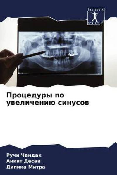 Procedury po uwelicheniü sinusow