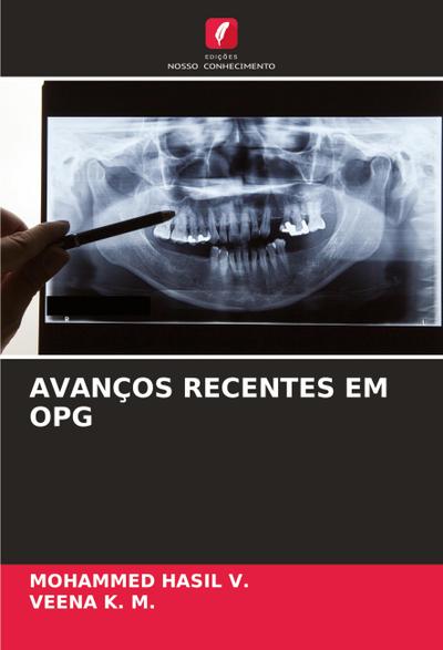 AVANÇOS RECENTES EM OPG - Mohammed Hasil V.