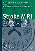 Stroke MRI