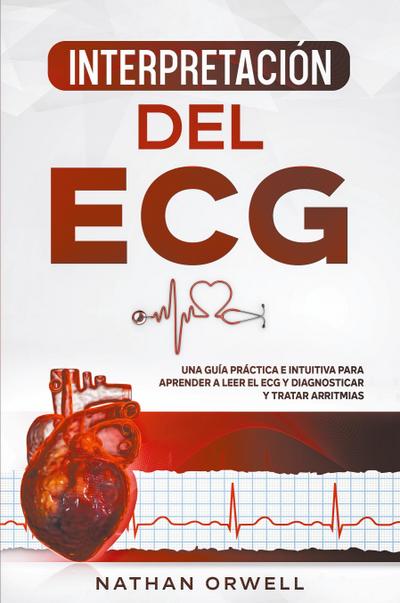 Interpretación del ECG