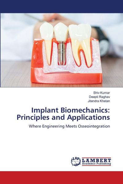 Implant Biomechanics: Principles and Applications