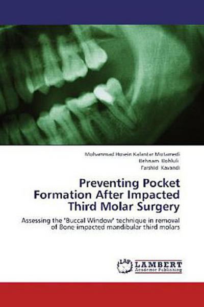 Preventing Pocket Formation After Impacted Third Molar Surgery