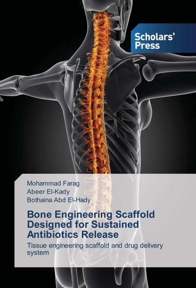 Bone Engineering Scaffold Designed for Sustained Antibiotics Release