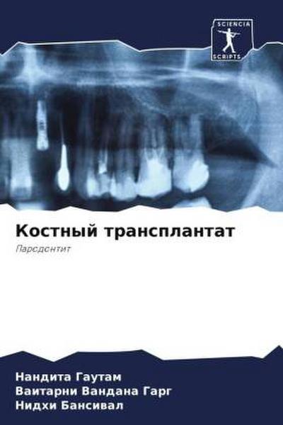 Kostnyj transplantat