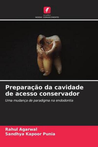 Preparação da cavidade de acesso conservador