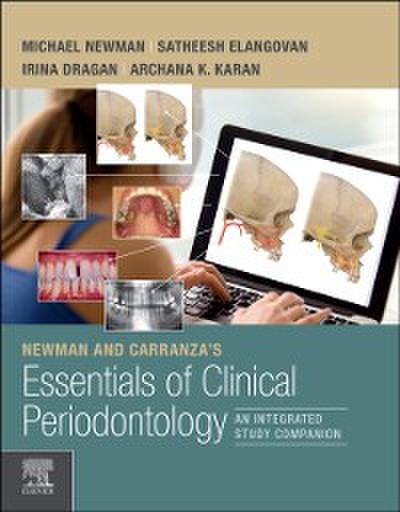 Newman and Carranza’s Essentials of Clinical Periodontology E-Book