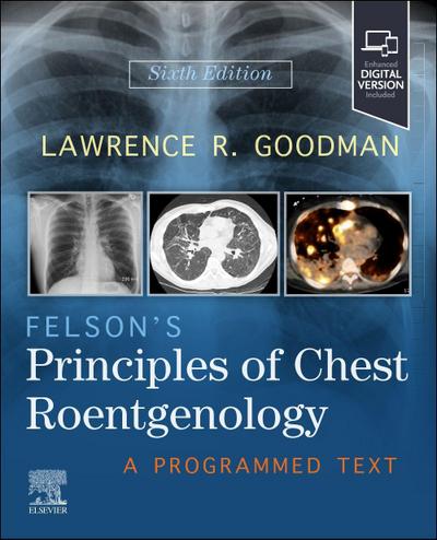 Felson’s Principles of Chest Roentgenology