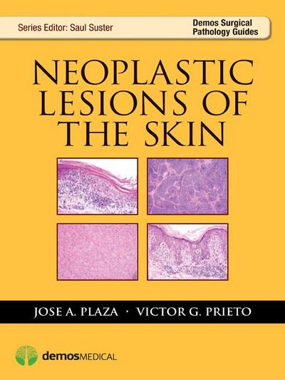 Neoplastic Lesions of the Skin