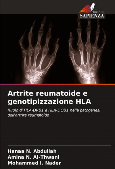 Artrite reumatoide e genotipizzazione HLA