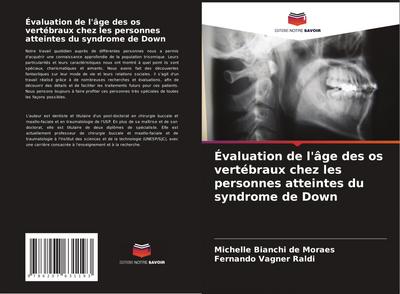 Évaluation de l’âge des os vertébraux chez les personnes atteintes du syndrome de Down
