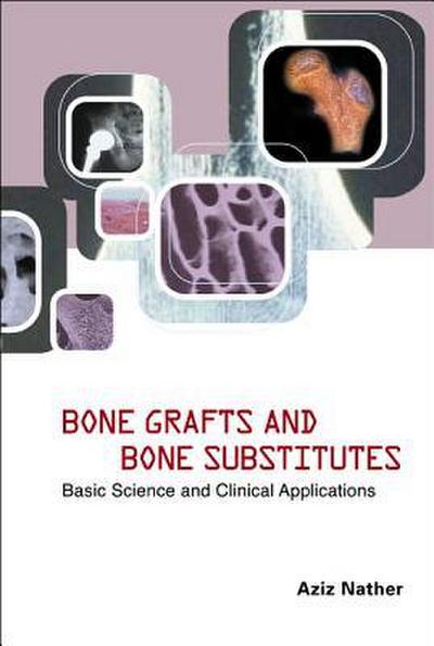 Bone Grafts and Bone Substitutes: Basic Science and Clinical Applications