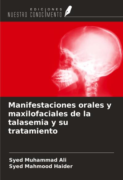 Manifestaciones orales y maxilofaciales de la talasemia y su tratamiento