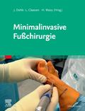 Minimalinvasive Fußchirurgie