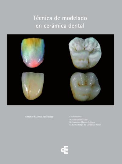 Técnica de modelado en cerámica dental