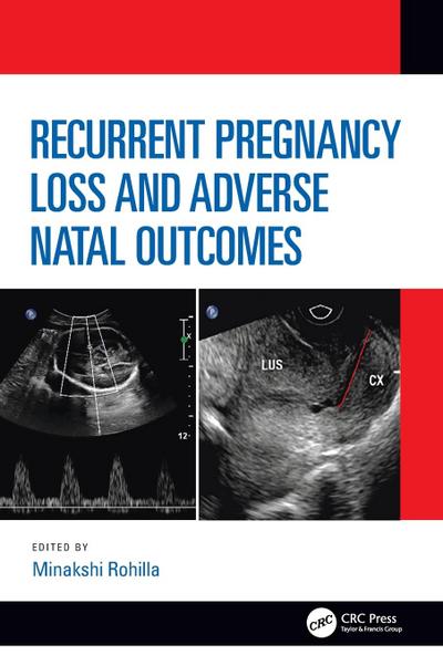 Recurrent Pregnancy Loss and Adverse Natal Outcomes