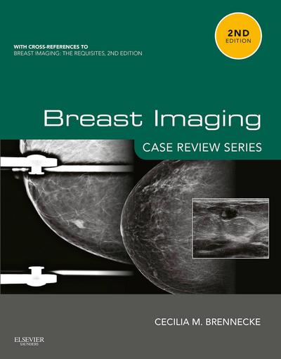Breast Imaging: Case Review Series E-Book