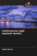 Controversie sugli impianti dentali