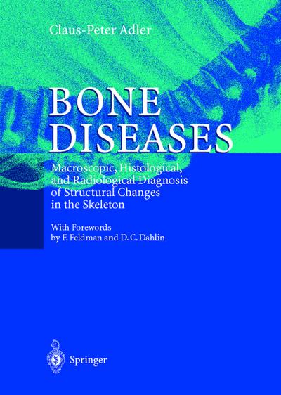 Bone Diseases