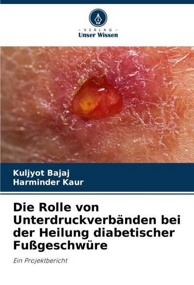 Die Rolle von Unterdruckverbänden bei der Heilung diabetischer Fußgeschwüre