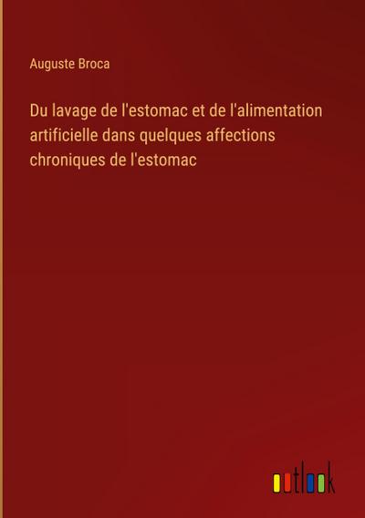 Du lavage de l’estomac et de l’alimentation artificielle dans quelques affections chroniques de l’estomac