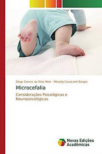 Microcefalia