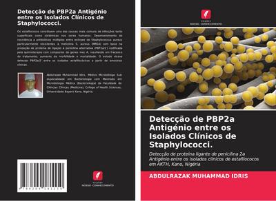 Detecção de PBP2a Antigénio entre os Isolados Clínicos de Staphylococci.