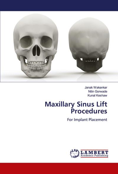 Maxillary Sinus Lift Procedures