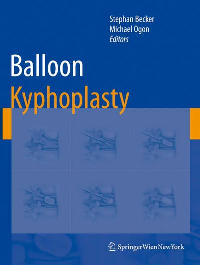 Balloon Kyphoplasty