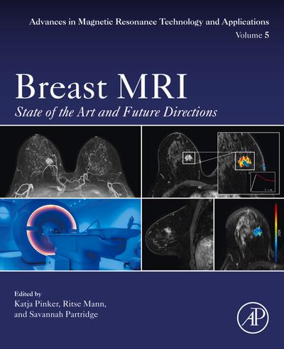 Breast MRI