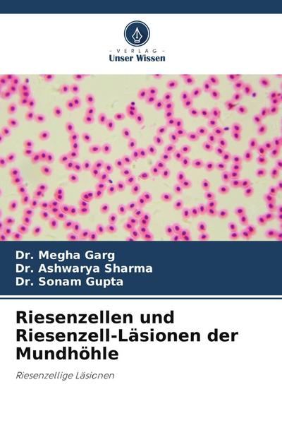 Riesenzellen und Riesenzell-Läsionen der Mundhöhle