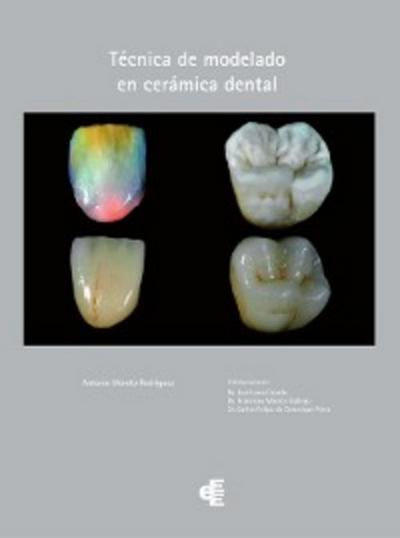 Técnica de modelado en cerámica dental