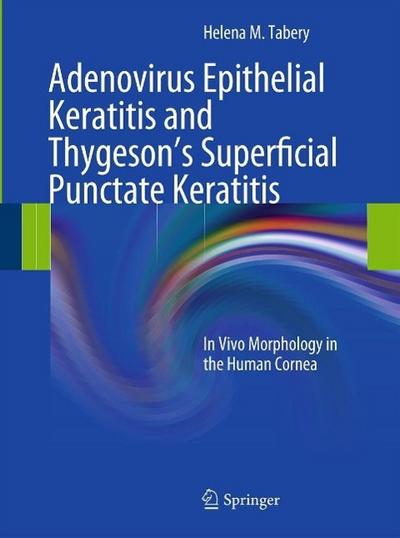 Adenovirus Epithelial Keratitis and Thygeson’s Superficial Punctate Keratitis
